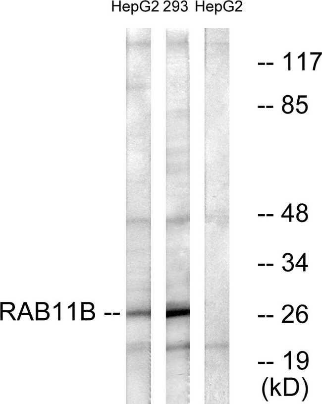 RAB11B Antibody - Western blot analysis of lysates from HepG2 and 293 cells, using RAB11B Antibody. The lane on the right is blocked with the synthesized peptide.