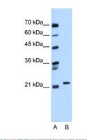 RAB11B Antibody - Lane A: Marker. Lane B: Jurkat cell lysate. Antibody concentration: 0.25 ug/ml. Gel concentration: 12%.  This image was taken for the unconjugated form of this product. Other forms have not been tested.