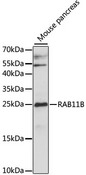 RAB11B Antibody - Western blot analysis of extracts of Mouse pancreas, using RAB11B antibody at 1:1000 dilution. The secondary antibody used was an HRP Goat Anti-Rabbit IgG (H+L) at 1:10000 dilution. Lysates were loaded 25ug per lane and 3% nonfat dry milk in TBST was used for blocking. An ECL Kit was used for detection and the exposure time was 120s.