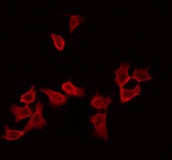 RAB11B Antibody - Staining HepG2 cells by IF/ICC. The samples were fixed with PFA and permeabilized in 0.1% Triton X-100, then blocked in 10% serum for 45 min at 25°C. The primary antibody was diluted at 1:200 and incubated with the sample for 1 hour at 37°C. An Alexa Fluor 594 conjugated goat anti-rabbit IgG (H+L) Ab, diluted at 1/600, was used as the secondary antibody.