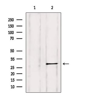 RAB11B Antibody - Western blot analysis of extracts of HepG2 cells using Rab 11B antibody. Lane 1 was treated with the blocking peptide.