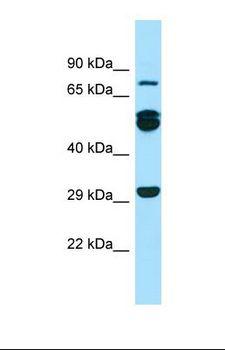 RAB11FIP1 Antibody - Western blot of Human THP-1. RAB11FIP1 antibody dilution 1.0 ug/ml.  This image was taken for the unconjugated form of this product. Other forms have not been tested.