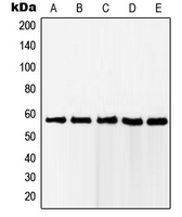 RAB11FIP2 / Rab11-FIP2 Antibody - Western blot analysis of RAB11FIP2 expression in Jurkat (A); HeLa (B); MCF7 (C); A431 (D); HEK293 (E) whole cell lysates.