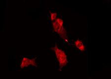 RAB11FIP2 / Rab11-FIP2 Antibody - Staining MCF-7 cells by IF/ICC. The samples were fixed with PFA and permeabilized in 0.1% Triton X-100, then blocked in 10% serum for 45 min at 25°C. The primary antibody was diluted at 1:200 and incubated with the sample for 1 hour at 37°C. An Alexa Fluor 594 conjugated goat anti-rabbit IgG (H+L) Ab, diluted at 1/600, was used as the secondary antibody.