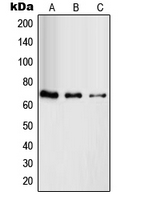 RAB11FIP4 / RAB11-FIP4 Antibody - Western blot analysis of RAB11FIP4 expression in HUVEC (A); HeLa (B); HT29 (C) whole cell lysates.