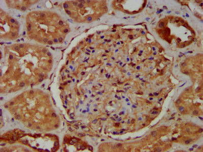 RAB11FIP5 / RIP11 Antibody - Immunohistochemistry image at a dilution of 1:400 and staining in paraffin-embedded human kidney tissue performed on a Leica BondTM system. After dewaxing and hydration, antigen retrieval was mediated by high pressure in a citrate buffer (pH 6.0) . Section was blocked with 10% normal goat serum 30min at RT. Then primary antibody (1% BSA) was incubated at 4 °C overnight. The primary is detected by a biotinylated secondary antibody and visualized using an HRP conjugated SP system.