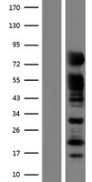 RAB11FIP5 / RIP11 Protein - Western validation with an anti-DDK antibody * L: Control HEK293 lysate R: Over-expression lysate