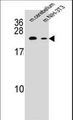 RAB12 Antibody - RAB12 Antibody western blot of mouse cerebellum tissue and mouse NIH-3T3 cell line lysates (35 ug/lane). The RAB12 antibody detected the RAB12 protein (arrow).