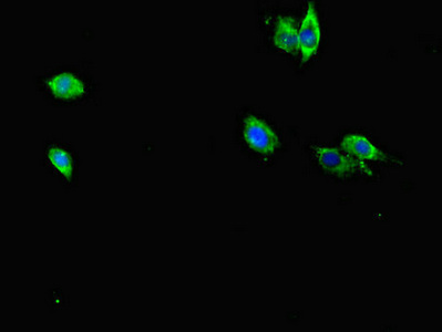 RAB12 Antibody - Immunofluorescent analysis of Hela cells diluted at 1:100 and Alexa Fluor 488-congugated AffiniPure Goat Anti-Rabbit IgG(H+L)