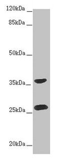 RAB12 Antibody - Western blot All lanes: RAB12 antibody at 2µg/ml + Hela whole cell lysate Secondary Goat polyclonal to rabbit IgG at 1/10000 dilution Predicted band size: 28 kDa Observed band size: 28, 36 kDa