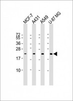 RAB13 Antibody - All lanes: Anti-RAB13 Antibody at 1:1000 dilution. Lane 1: MCF-7 whole cell lysate. Lane 2: A431 whole cell lysate. Lane 3: A549 whole cell lysate. Lane 4: U-87 MG whole cell lysate Lysates/proteins at 20 ug per lane. Secondary Goat Anti-mouse IgG, (H+L), Peroxidase conjugated at 1:10000 dilution. Predicted band size: 23 kDa. Blocking/Dilution buffer: 5% NFDM/TBST.