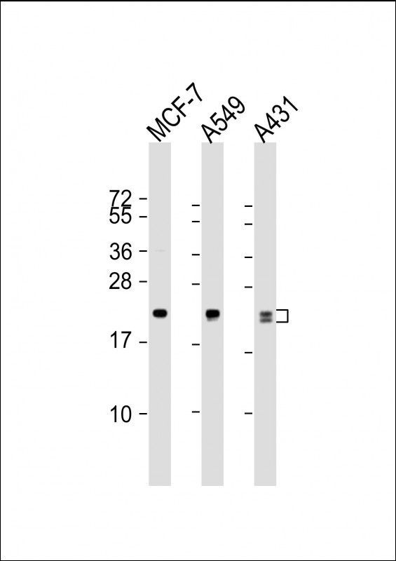 RAB13 Antibody - All lanes: Anti-RAB13 Antibody at 1:1000 dilution. Lane 1: MCF-7 whole cell lysate. Lane 2: A549 whole cell lysate. Lane 3: A431 whole cell lysate Lysates/proteins at 20 ug per lane. Secondary Goat Anti-mouse IgG, (H+L), Peroxidase conjugated at 1:10000 dilution. Predicted band size: 23 kDa. Blocking/Dilution buffer: 5% NFDM/TBST.