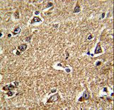 RAB13 Antibody - Formalin-fixed and paraffin-embedded human brain tissue reacted with RAB13 Antibody , which was peroxidase-conjugated to the secondary antibody, followed by DAB staining. This data demonstrates the use of this antibody for immunohistochemistry; clinical relevance has not been evaluated.