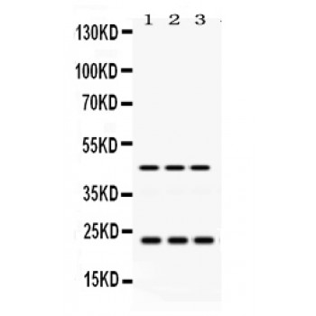 RAB13 Antibody - RAB13 antibody Western blot. All lanes: Anti RAB13 at 0.5 ug/ml. Lane 1: Rat Kidney Tissue Lysate at 50 ug. Lane 2: HELA Whole Cell Lysate at 40 ug. Lane 3: HEPG2 Whole Cell Lysate at 40 ug. Predicted band size: 23 kD, 45 kD. Observed band size: 23 kD, 45 kD.