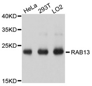 RAB13 Antibody - Western blot analysis of extracts of various cell lines, using RAB13 antibody at 1:1000 dilution. The secondary antibody used was an HRP Goat Anti-Rabbit IgG (H+L) at 1:10000 dilution. Lysates were loaded 25ug per lane and 3% nonfat dry milk in TBST was used for blocking. An ECL Kit was used for detection and the exposure time was 1s.