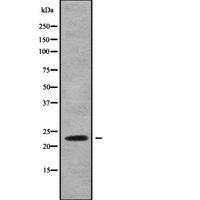 RAB13 Antibody - Western blot analysis of RAB13 using COLO205 whole cells lysates