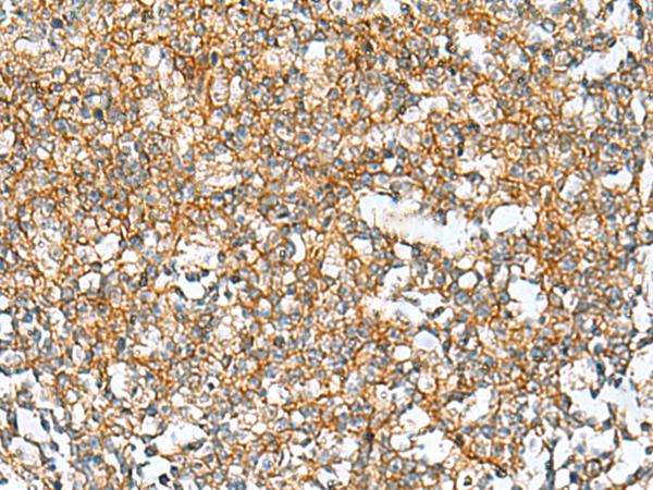 RAB13 Antibody - Immunohistochemistry of paraffin-embedded Human tonsil tissue  using RAB13 Polyclonal Antibody at dilution of 1:50(×200)