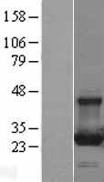 RAB13 Protein - Western validation with an anti-DDK antibody * L: Control HEK293 lysate R: Over-expression lysate