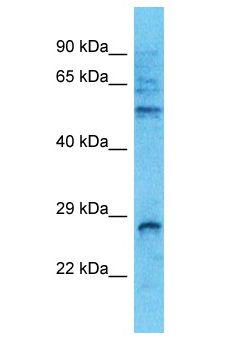 RAB14 Antibody - RAB14 antibody Western Blot of THP-1. Antibody dilution: 1 ug/ml.  This image was taken for the unconjugated form of this product. Other forms have not been tested.