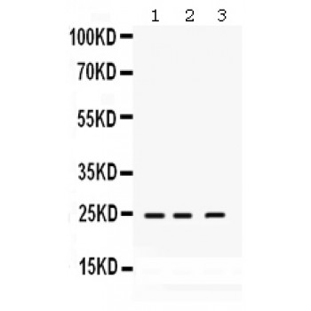 RAB14 Antibody - RAB14 antibody Western blot. All lanes: Anti RAB14 at 0.5 ug/ml. Lane 1: Rat Brain Tissue Lysate at 50 ug. Lane 2: RAJI Whole Cell Lysate at 40 ug. Lane 3: SMMC Whole Cell Lysate at 40 ug. Predicted band size: 24 kD. Observed band size: 24 kD.