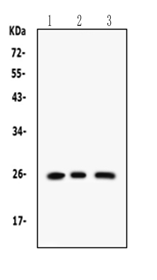 RAB14 Antibody - Anti-RAB14 Picoband antibody Western blotting All lanes: Anti RAB14 at 0.5ug/ml Lane 1: Rat Brain Tissue Lysate at 50ugLane 2: RAJI Whole Cell Lysate at 40ugLane 3: SMMC Whole Cell Lysate at 40ugPredicted bind size: 24KD Observed bind size: 24KD