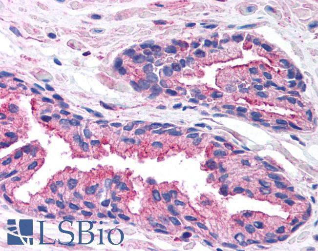 RAB14 Antibody - Anti-RAB14 antibody IHC of human prostate. Immunohistochemistry of formalin-fixed, paraffin-embedded tissue after heat-induced antigen retrieval. Antibody concentration 5 ug/ml.  This image was taken for the unconjugated form of this product. Other forms have not been tested.