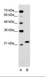 RAB14 Antibody - A: Marker, HepG2 Cell Lysate.  This image was taken for the unconjugated form of this product. Other forms have not been tested.