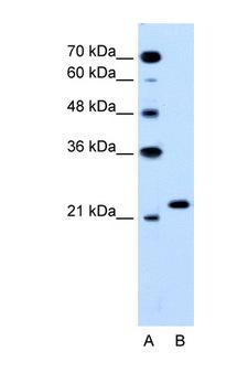 RAB14 Antibody - RAB14 antibody Western blot of HepG2 Cell lysate. Antibody concentration 1 ug/ml. This image was taken for the unconjugated form of this product. Other forms have not been tested.