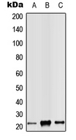 RAB14 Antibody - Western blot analysis of RAB14 expression in Jurkat (A); Raw264.7 (B); PC12 (C) whole cell lysates.