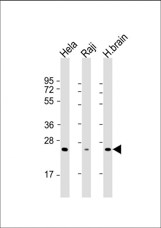 RAB14 Antibody - All lanes: Anti-RAB14 Antibody at 1:2000 dilution Lane 1: Hela whole cell lysate Lane 2: Raji whole cell lysate Lane 3: human brain lysate Lysates/proteins at 20 µg per lane. Secondary Goat Anti-mouse IgG, (H+L), Peroxidase conjugated at 1/10000 dilution. Predicted band size: 24 kDa Blocking/Dilution buffer: 5% NFDM/TBST.