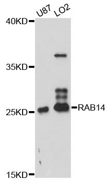 RAB14 Antibody - Western blot analysis of extracts of various cell lines, using RAB14 antibody at 1:3000 dilution. The secondary antibody used was an HRP Goat Anti-Rabbit IgG (H+L) at 1:10000 dilution. Lysates were loaded 25ug per lane and 3% nonfat dry milk in TBST was used for blocking. An ECL Kit was used for detection and the exposure time was 90s.
