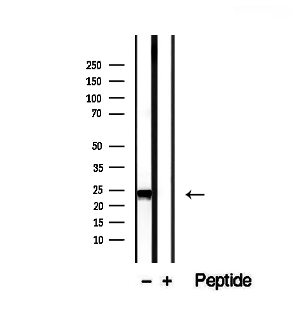 RAB14 Antibody - Western blot analysis of extracts of HepG2 cells using RAB14 antibody.