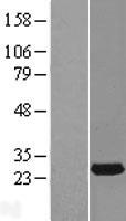 RAB14 Protein - Western validation with an anti-DDK antibody * L: Control HEK293 lysate R: Over-expression lysate