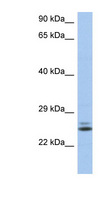 RAB15 Antibody - RAB15 antibody Western blot of THP-1 cell lysate. This image was taken for the unconjugated form of this product. Other forms have not been tested.
