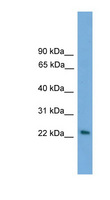 RAB15 Antibody - RAB15 antibody Western blot of Placenta lysate. This image was taken for the unconjugated form of this product. Other forms have not been tested.