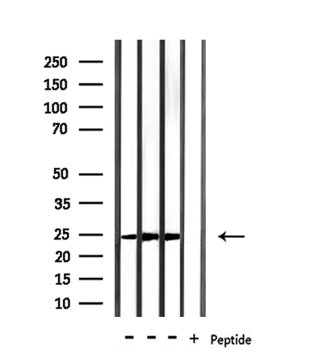 RAB15 Antibody - Western blot analysis of extracts of mouse brain, mouse liver, rat brain tissue using RAB15 antibody.