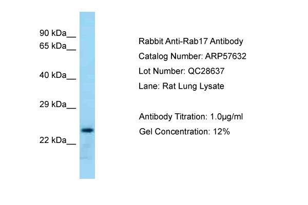 RAB17 Antibody -  This image was taken for the unconjugated form of this product. Other forms have not been tested.