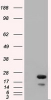 RAB17 Antibody - HEK293T cells were transfected with the pCMV6-ENTRY control (Left lane) or pCMV6-ENTRY RAB17 (Right lane) cDNA for 48 hrs and lysed. Equivalent amounts of cell lysates (5 ug per lane) were separated by SDS-PAGE and immunoblotted with anti-RAB17.