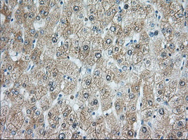 RAB17 Antibody - IHC of paraffin-embedded Human liver tissue using anti-RAB17 mouse monoclonal antibody. (Dilution 1:50).