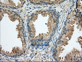 RAB17 Antibody - IHC of paraffin-embedded Human prostate tissue using anti-RAB17 mouse monoclonal antibody. (Dilution 1:50).