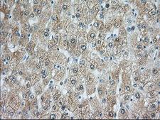 RAB17 Antibody - IHC of paraffin-embedded Human liver tissue using anti-RAB17 mouse monoclonal antibody. (Dilution 1:50).