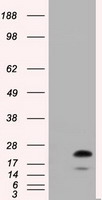RAB17 Antibody - HEK293T cells were transfected with the pCMV6-ENTRY control (Left lane) or pCMV6-ENTRY RAB17 (Right lane) cDNA for 48 hrs and lysed. Equivalent amounts of cell lysates (5 ug per lane) were separated by SDS-PAGE and immunoblotted with anti-RAB17.
