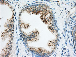 RAB17 Antibody - IHC of paraffin-embedded Human prostate tissue using anti-RAB17 mouse monoclonal antibody. (Dilution 1:50).