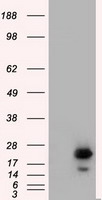 RAB17 Antibody - HEK293T cells were transfected with the pCMV6-ENTRY control (Left lane) or pCMV6-ENTRY RAB17 (Right lane) cDNA for 48 hrs and lysed. Equivalent amounts of cell lysates (5 ug per lane) were separated by SDS-PAGE and immunoblotted with anti-RAB17.