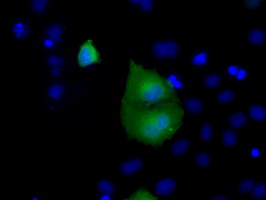 RAB17 Antibody - Anti-RAB17 mouse monoclonal antibody  immunofluorescent staining of COS7 cells transiently transfected by pCMV6-ENTRY RAB17.