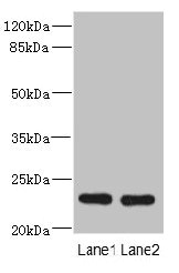RAB17 Antibody - Western blot All Lanes: RAB17 antibody at 3.02ug/ml Lane 1: Mouse brain tissue Lane 2: Mouse kidney tissue Secondary Goat polyclonal to Rabbit IgG at 1/10000 dilution Predicted band size: 24,10 kDa Observed band size: 23 kDa