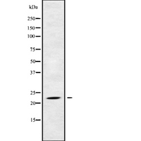 RAB17 Antibody - Western blot analysis of RAB17 using HuvEc whole cells lysates