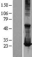 RAB17 Protein - Western validation with an anti-DDK antibody * L: Control HEK293 lysate R: Over-expression lysate