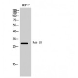 RAB18 Antibody - Western blot of Rab 18 antibody