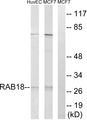 RAB18 Antibody - Western blot analysis of lysates from MCF-7 and HUVEC cells, using RAB18 Antibody. The lane on the right is blocked with the synthesized peptide.
